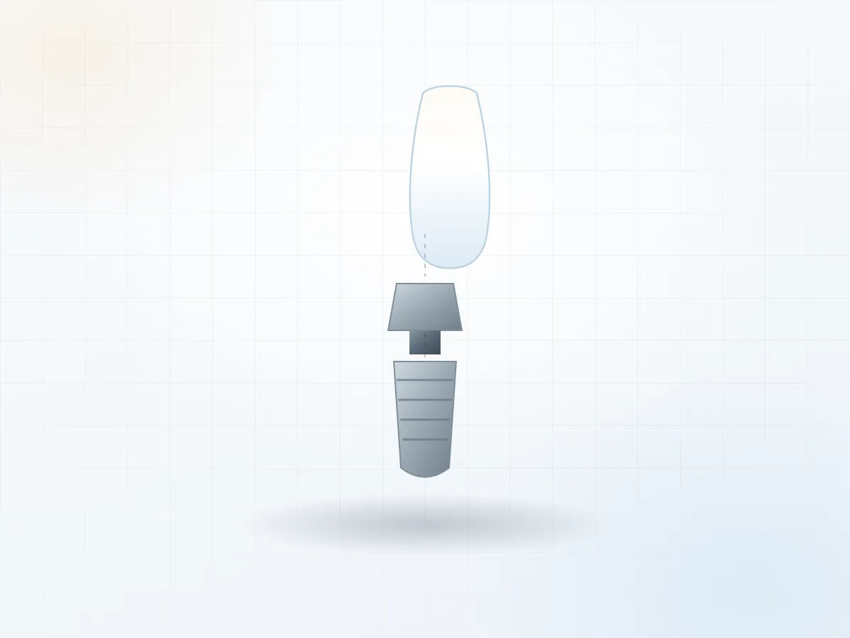 Mão sứ trên Implant & Abutment cá nhân hoá